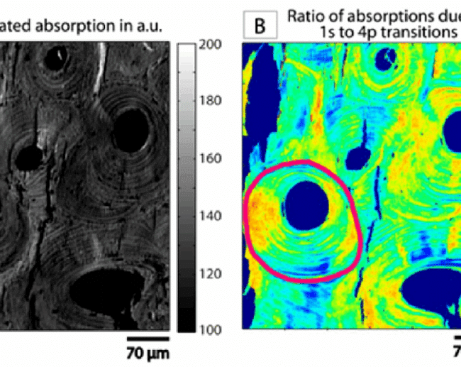 Spectroscopie d’absorption des rayons X du calcium à l’échelle du micron sur l’os cortical